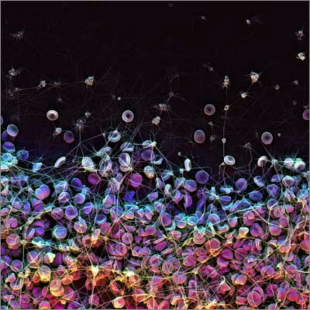 Фотография, сделанная сканирующим электронным микроскопом: красные кровяные клетки собираются вместе, сгущая кровь перед образованием тромба (фото James Weaver, Harvard’s Wyss Institute).