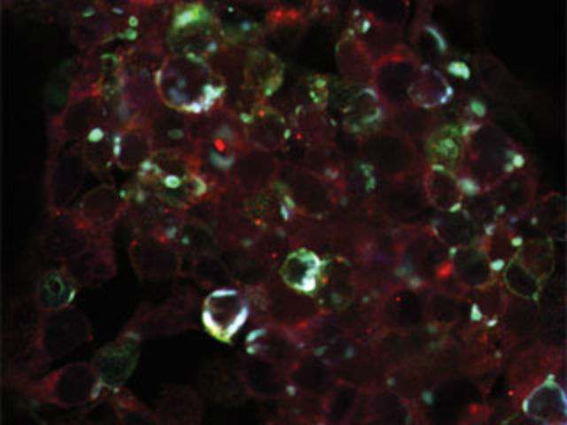 Железные наночастицы (голубые) открывают ионные каналы (красные), активируя белок TRPV1 (зелёный) (фото Rensselaer Polytechnic Institute). 