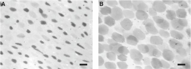 Хроматофоры в их нормальном состоянии (слева) и в состоянии максимального расширения (фото UCSB).