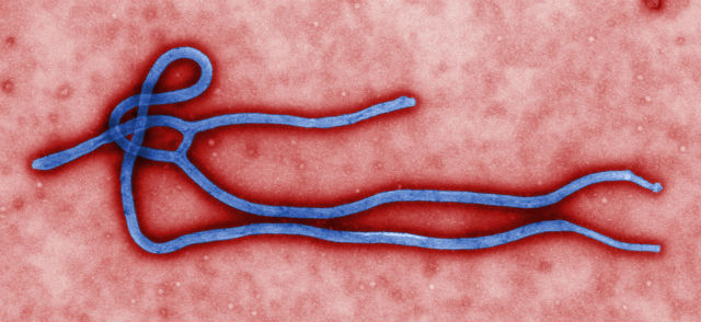Вирус Эбола, возбудитель лихорадки (фото Wikimedia Commons). 