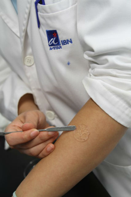 Наногель на основе пептидов ускоряет заживление ожоговых ран почти на 40% (фото Institute of Bioengineering and Nanotechnology).