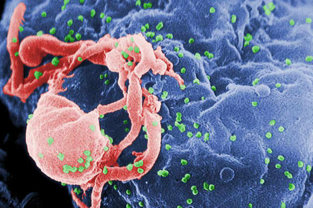 ВИЧ в первую очередь атакует белые кровяные клетки, разрушая таким образом иммунную защиту (фото Wikimedia Commons). 
