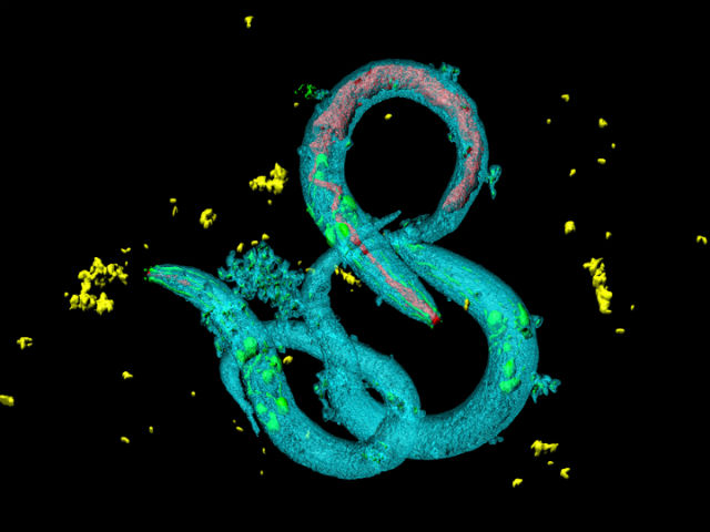 Нематода, представитель вида Caenorhabditis elegans (фото Heiti Paves). 